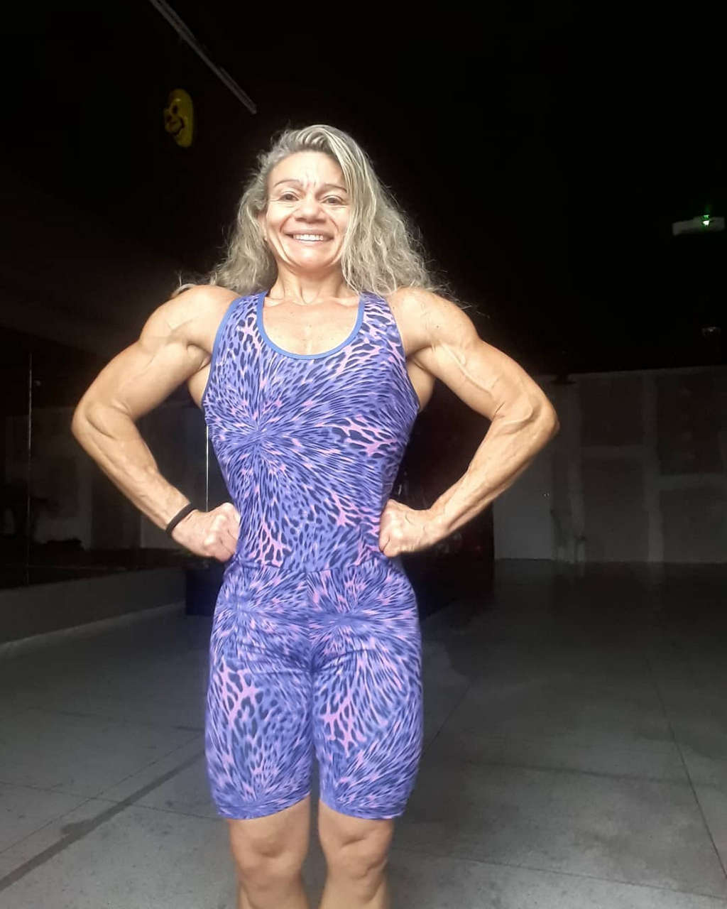 Antonia Gardenia Almeida Muscles