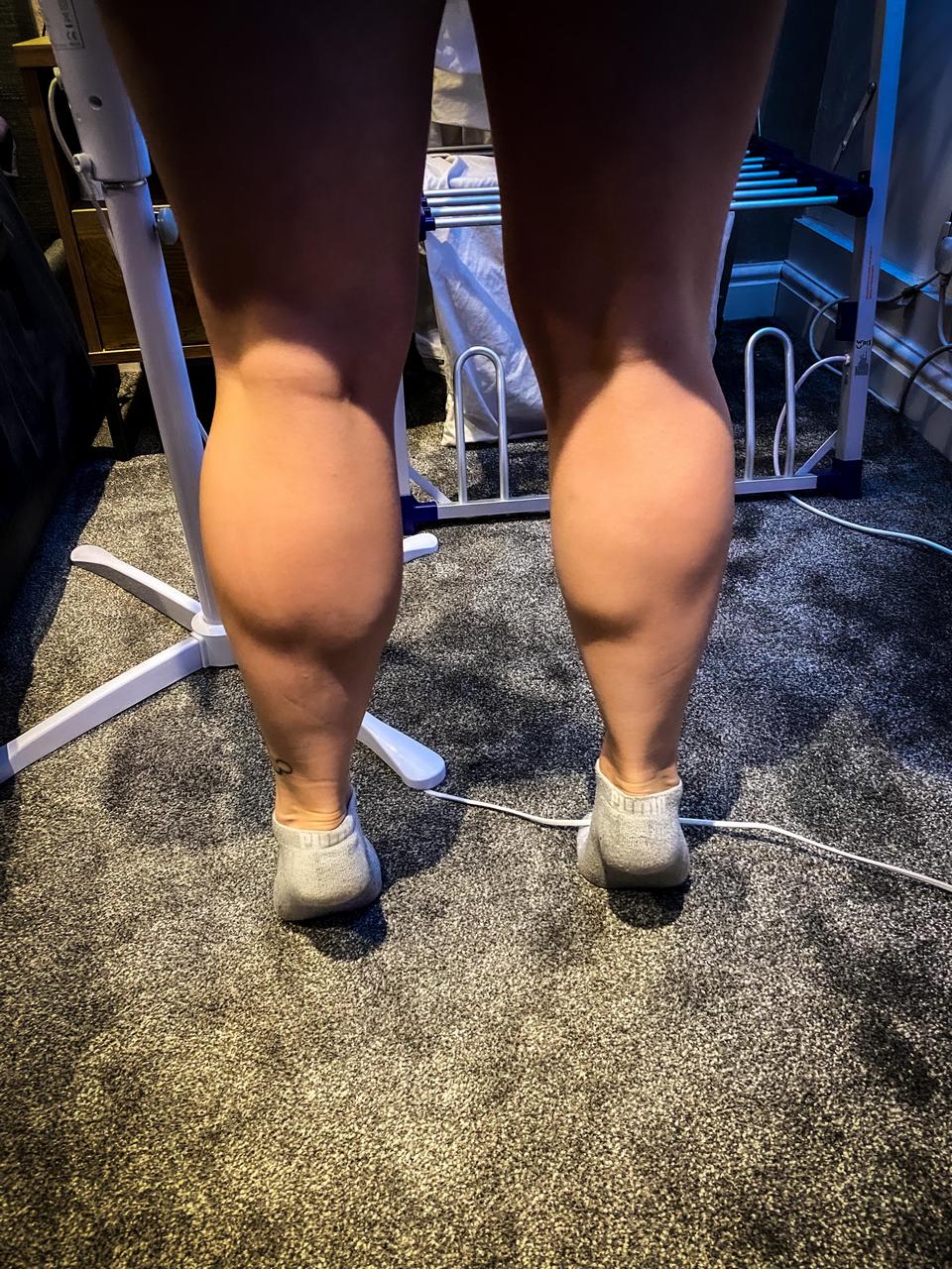 I Love How Pumped My Calves Get During My Rehab NSFW