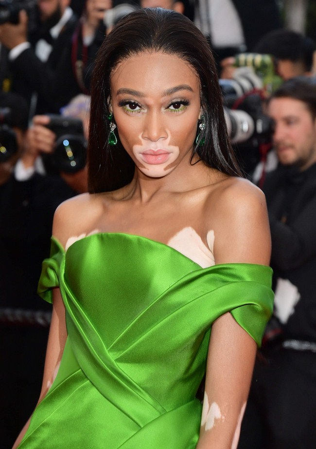 Winnie Harlow NSFW