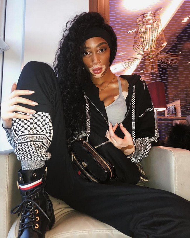 Winnie Harlow NSFW