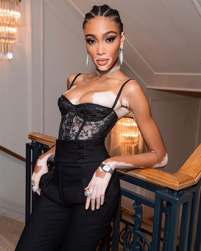 Winnie Harlow NSFW