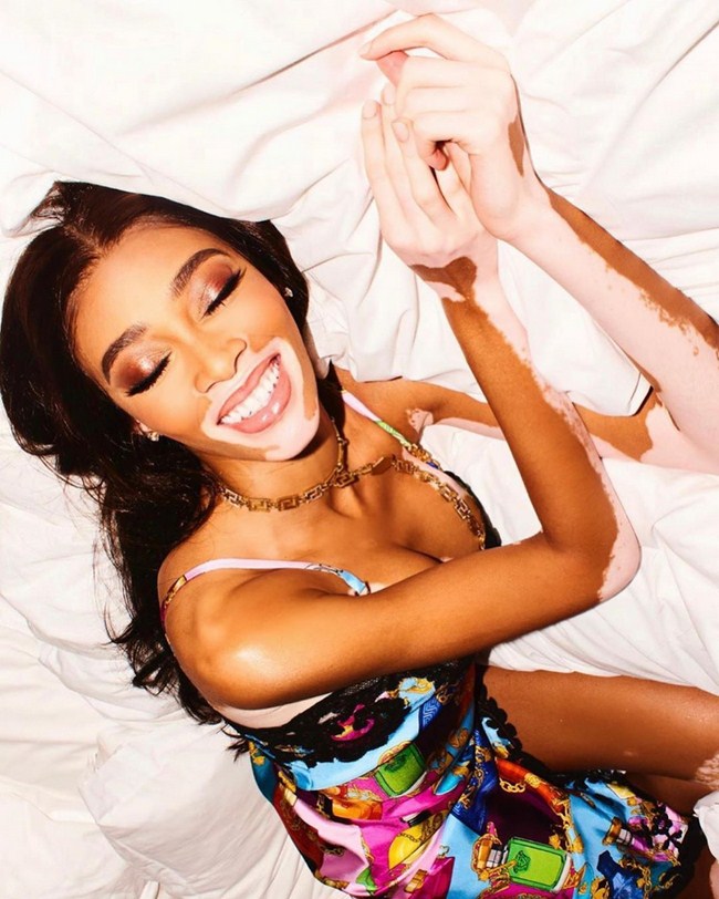 Winnie Harlow NSFW