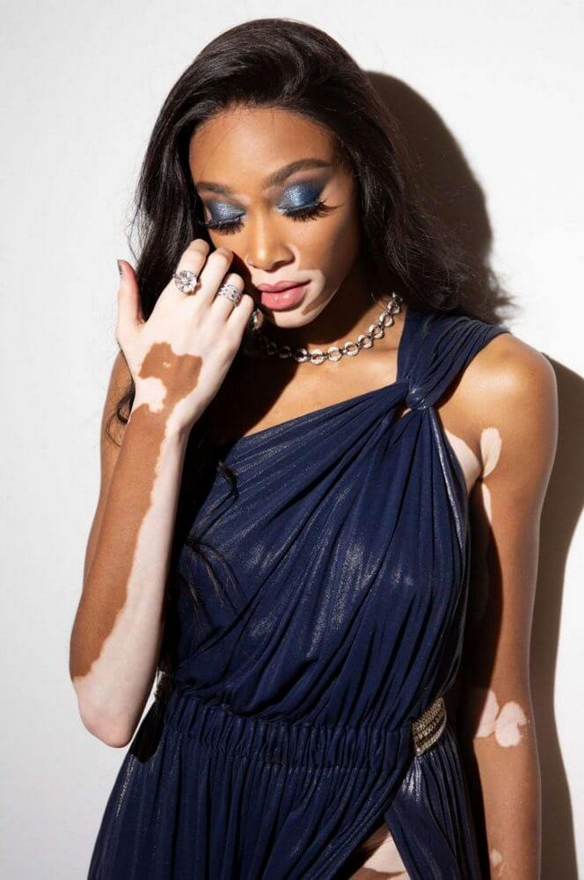 Winnie Harlow NSFW